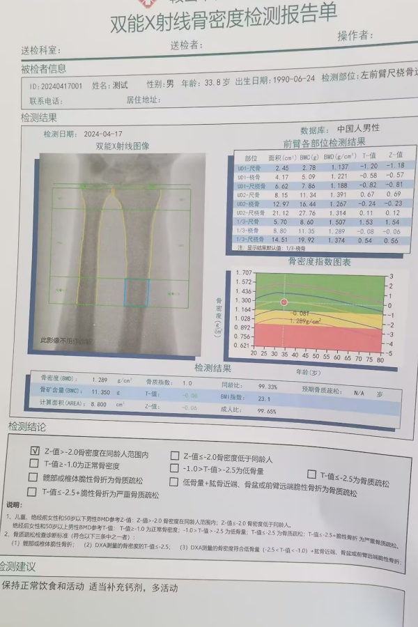 雙能X射線骨密度儀：準確測量骨密度，助力骨質(zhì)疏松防治，守護骨骼健康